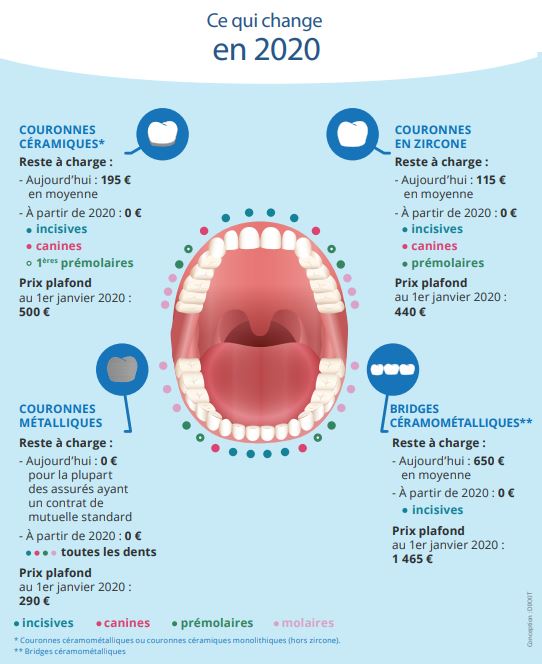 Remboursement 100% santé couronnes et bridge dentaire